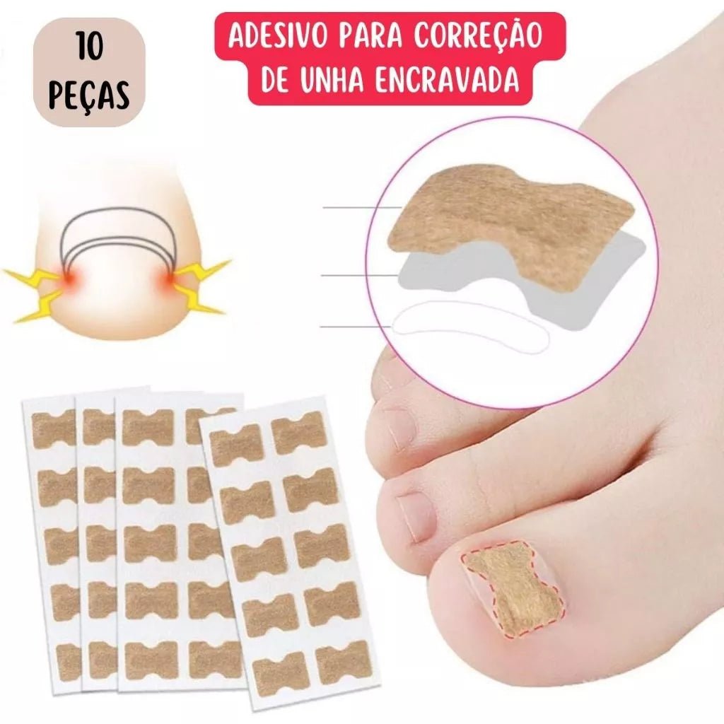 Correção de Unha Encravada (Cantoneira ou Adesivo Órtose) - Kit com 10 Unidades - Achei na Lojinha