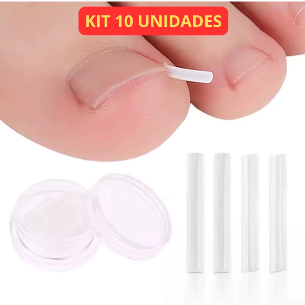 Correção de Unha Encravada (Cantoneira ou Adesivo Órtose) - Kit com 10 Unidades - Achei na Lojinha