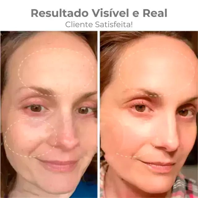 Massageador Facial Rejuvenescedor com Fototerapia Anti - Rugas - Achei na Lojinha