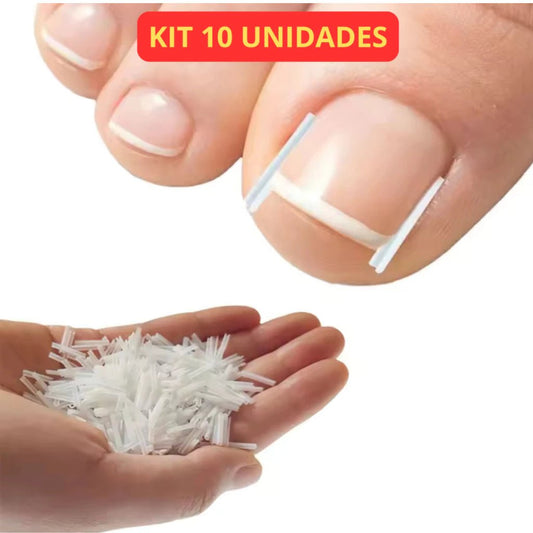 Correção de Unha Encravada (Cantoneira ou Adesivo Órtose) - Kit com 10 Unidades - Achei na Lojinha
