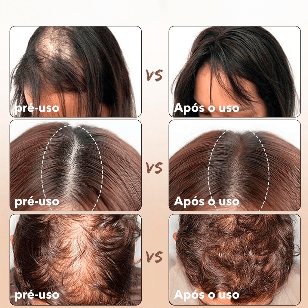 Sombra Capilar em Pó Jhessy – Cobre Falhas, Disfarça Fios Brancos e Realça a Linha do Cabelo - Achei na Lojinha